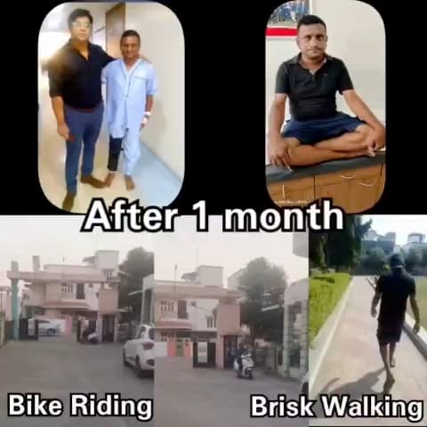 One month post-op knee surgery patient riding a bike and brisk walking