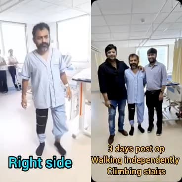 Patient walking independently three days after knee surgery with Dr. Manish Saini
