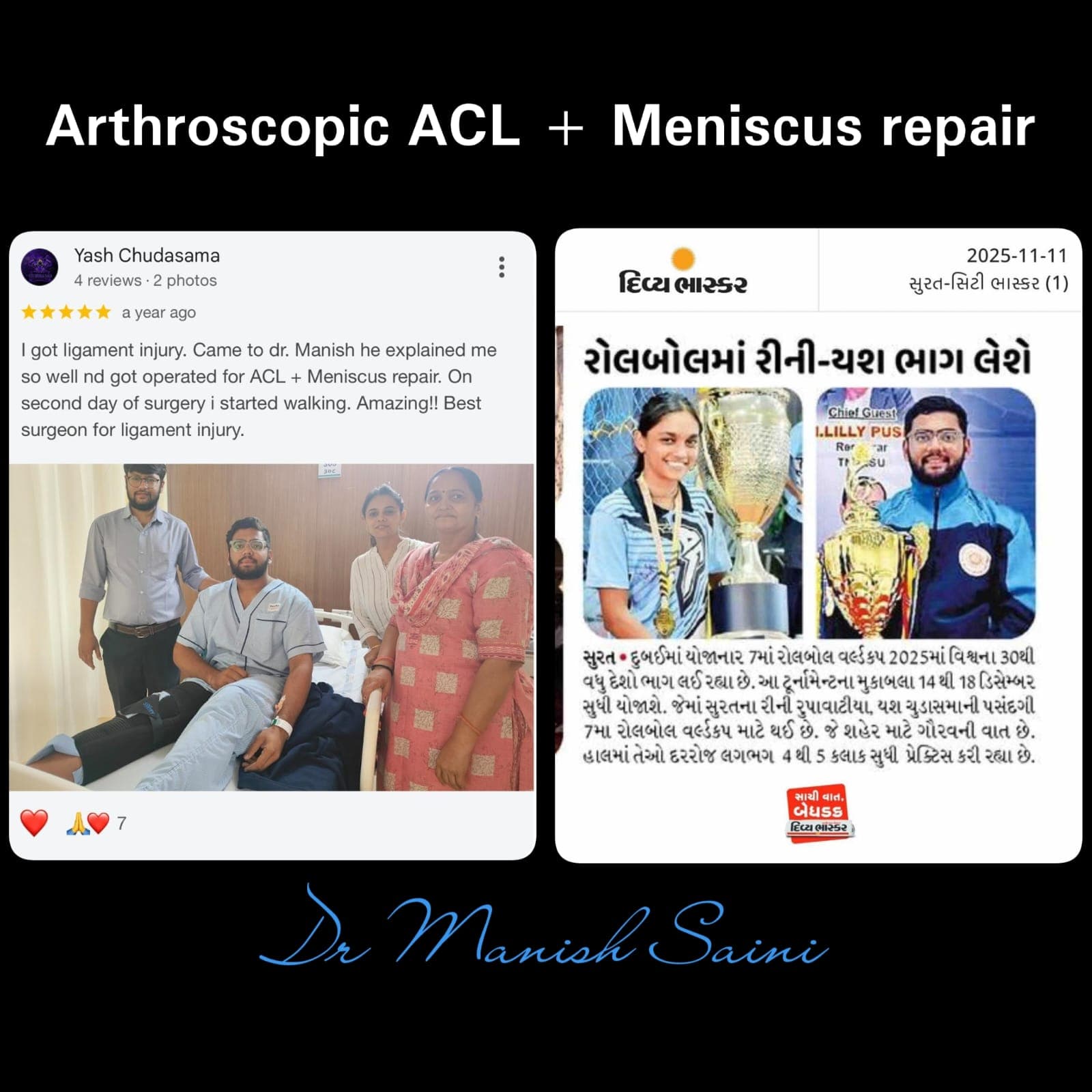 Patient testimonial with news clipping after arthroscopic ACL and meniscus repair by Dr. Manish Saini